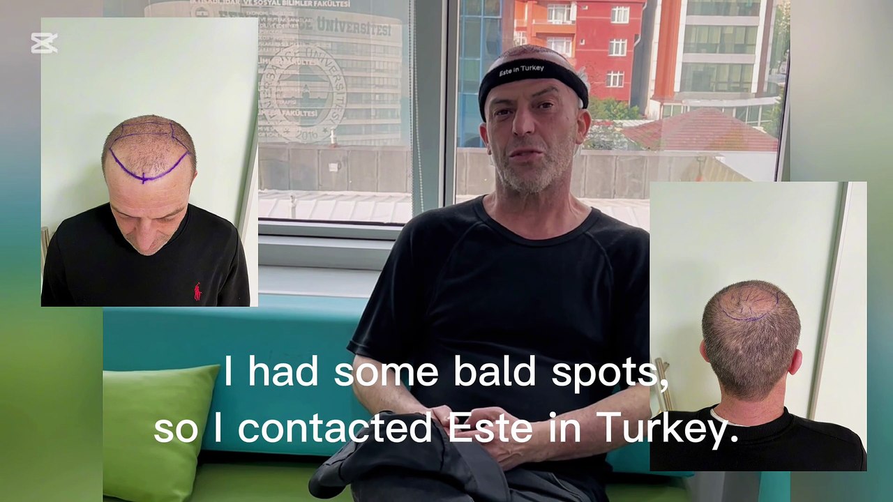 Клиенты Este in Turkey