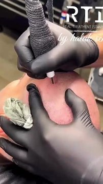 Saç Simülasyonu By Haluk Şener Saç Çözümleri Pigment İşleme SMP Telefon Aşağıda