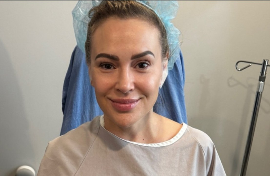 Alyssa Milano has breast implants removed