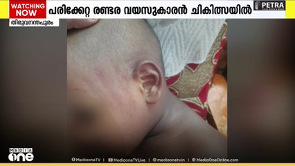 അങ്കണവാടി ടീച്ചർ മുഖത്തടിച്ച രണ്ടര വയസുകാരന്റെ ചെവിക്ക് പരിക്ക്; അധ്യപികയെ സസ്പെൻഡ് ചെയ്തു