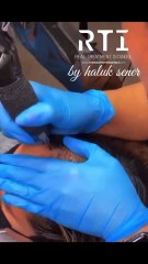 Saç Simülasyonu Gölgeleme Doğal Pigment ve Uzmanlık İçin Doğru Adres By Haluk Şener Telefon Aşağıda