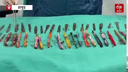 गजब! पेट से निकले 29 स्टील के चम्मच, 19 टूथब्रश; जबरन नशा मुक्ति केंद्र में भर्ती करने पर युवक ने की हरकत