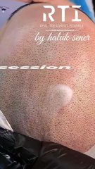 Saç Simülasyonu Gölgeleme Doğal Pigment ve Uzmanlık İçin Doğru Adres By Haluk Şener Telefon Aşağıda