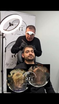 Saç Simülasyonu Gölgeleme Doğal Pigment ve Uzmanlık İçin Doğru Adres By Haluk Şener Telefon Aşağıda