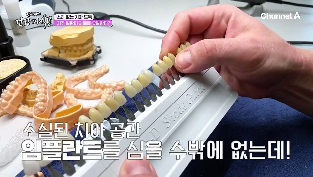 임플란트 시술=치료 끝? NO! 임플란트를 오래 동안 유지 할 수 있는 관리 비법은?