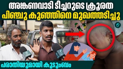 3 വയസായ കുഞ്ഞിൻ്റെ മുഖത്ത് അടിയേറ്റ പാടുകൾ | Anganwadi | Teacher