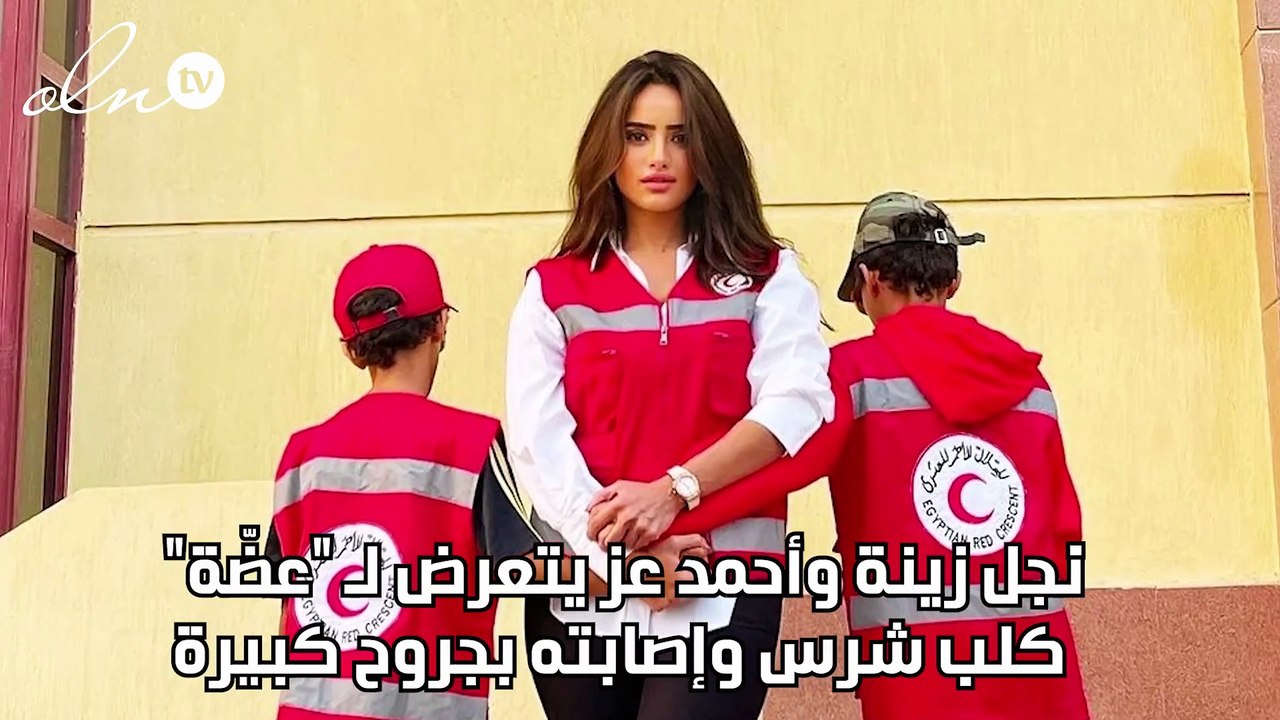 نجل زينة وأحمد عز يتعرض لـ "عضّة" كلب شرس وإصابته بجروح كبيرة