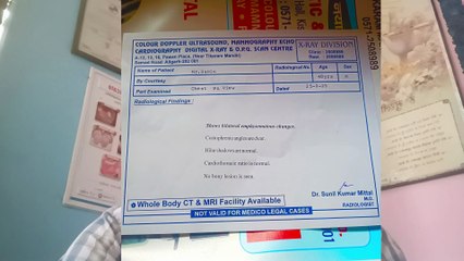 सालों से सांस फूलती थी जांच में आई भयंकर बीमारी अब मिलेगा इलाज से फायदा ।