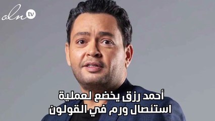 أحمد رزق يخضع لعملية استئصال ورم في القولون