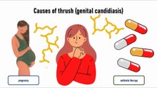 Causes of thrush (genital candidiasis)
