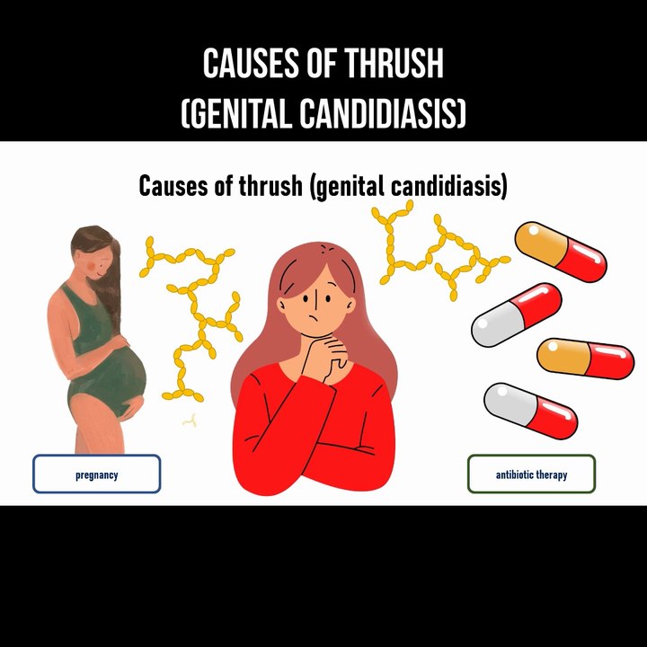 Causes of thrush (genital candidiasis)
