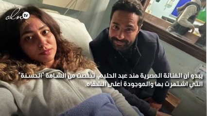 هند عبد الحليم تزيل الشامة المميزة بوجهها... كيف أصبح شكلها؟