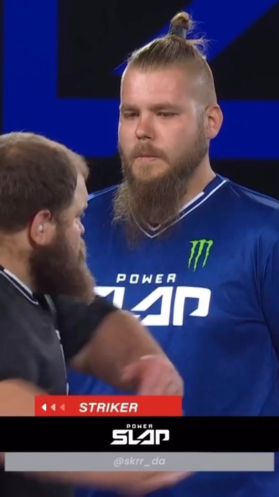 His eye took a trip 💀🥶
