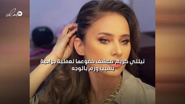 نيللي كريم تكشف خضوعها لعملية جراحية بسبب ورم بالوجه