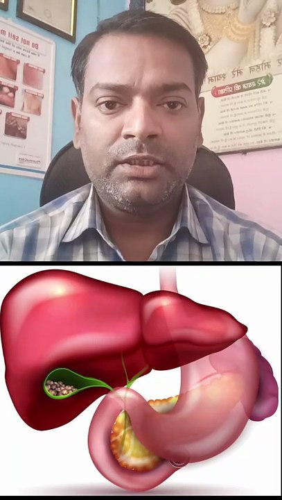 पित्ताशय की पथरी का सही इलाज क्या है ।