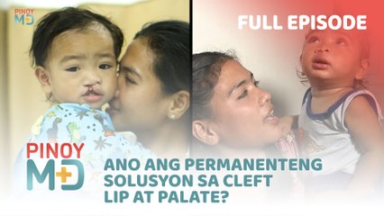 Ano ang permanenteng solusyon sa cleft lip at palate? (Full Episode) | Pinoy MD