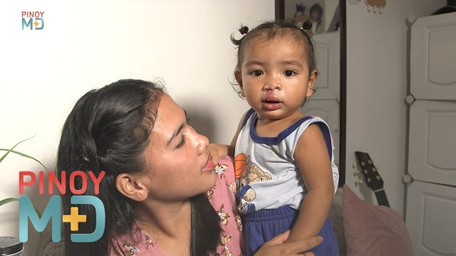 Libreng operasyon para sa may cleft lip at palate! | Pinoy MD
