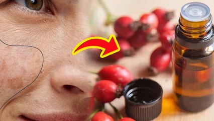 Pigmentation Oil For Face: चेहरे की झाइयों के लिए कौन सा तेल सबसे अच्छा है | Boldsky