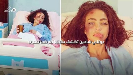 دوللي شاهين تكشف حقيقة تعرضها للضرب