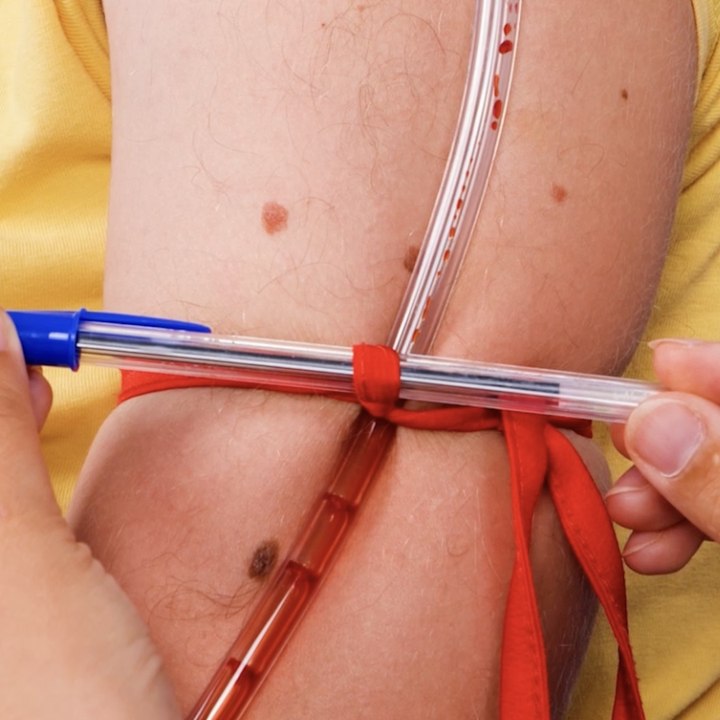 Les urgences du quotidien ? Essayez ces astuces géniales de premiers secours 🛑💡💡