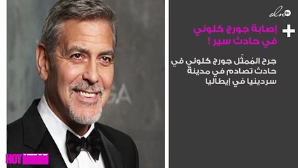 إصابة جورج كلوني في حادث سير.. وهذا وضعه الصحي