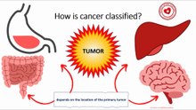 How is cancer classified?