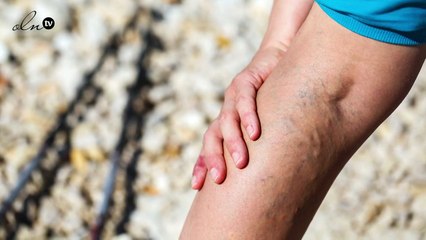 تعرّفي على التقنية الجديدة كلياً للتخلص من السيلوليت مع ناديا ناصيف