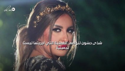 شذى حسّون لنواعم: العمليّة التي أجريتها ليست تجميلية
