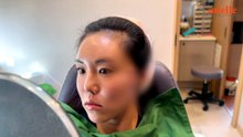 실리프팅 하기 전에 꼭 봐야하는 영상, 포니테일 실리프팅의 모든 것.