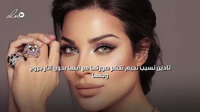 نادين نسيب نجيم تنشر صورتها مع ابنها بدون آثار جروح وجهها
