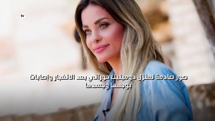 صور صادمة لمنزل دومينيك حوراني بعد الانفجار وإصابات بوجهها وجسدها