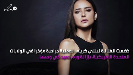 نيللي كريم تشكر دعم جمهورها بعد إزالة الورم
