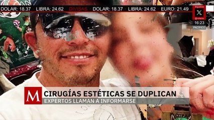 La realización de cirugías estéticas se han duplicado; los expertos piden informarse