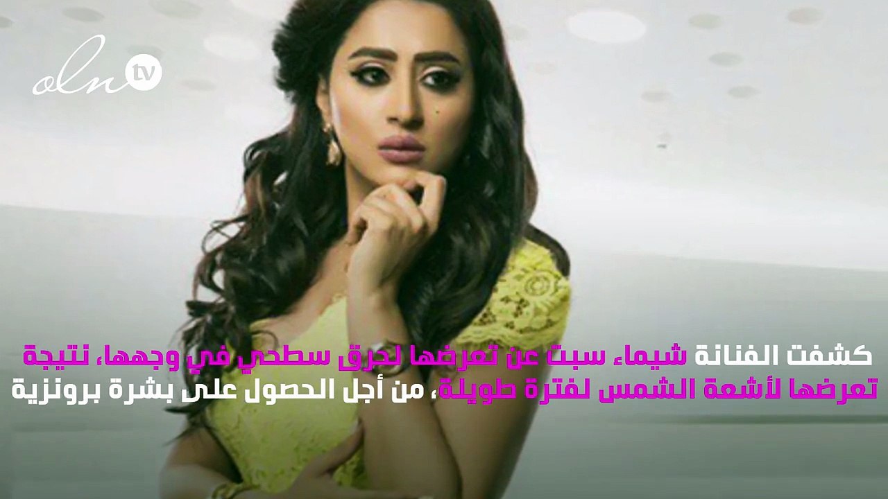 صور.. شيماء سبت تتعرّض لحروق في وجهها