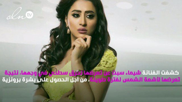 صور.. شيماء سبت تتعرّض لحروق في وجهها