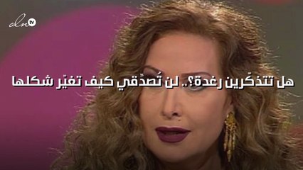 هل تتذكّرين رغدة؟.. لن تُصدِّقي كيف تغيّر شكلها!