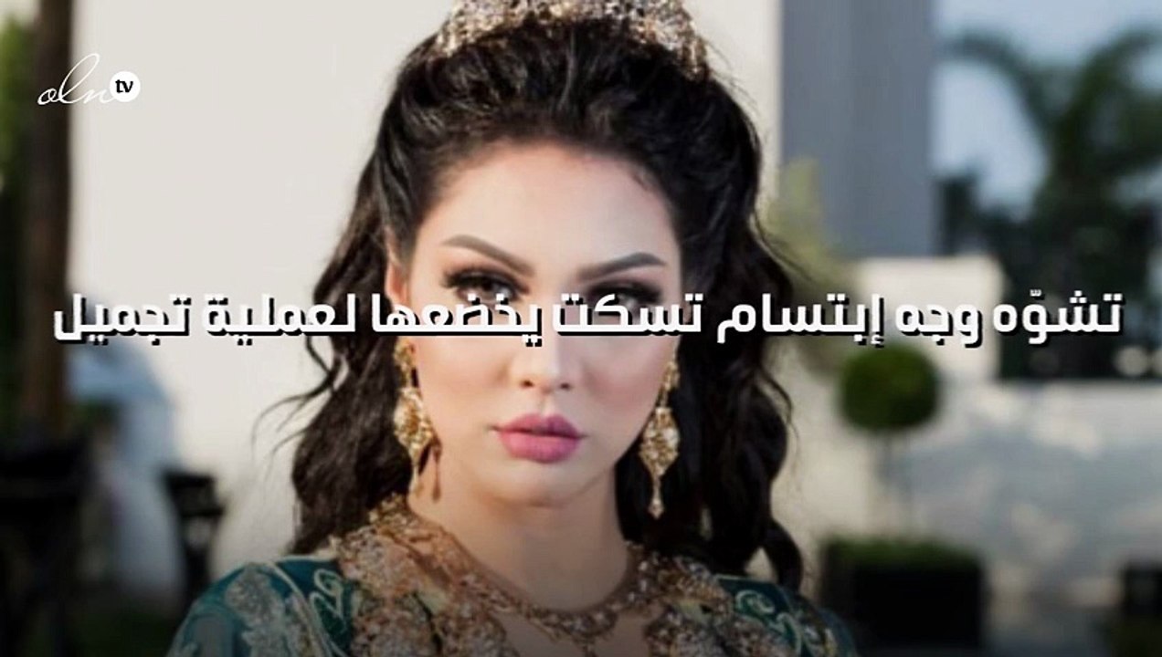 تشوّه وجه إبتسام تسكت يخضعها لعملية تجميل