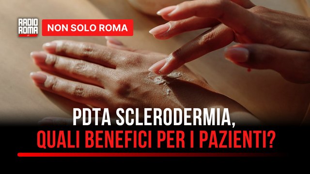 As.Ma.Ra Onlus, il convegno per celebrare un risultato importante il PDTA della Sclerodermia