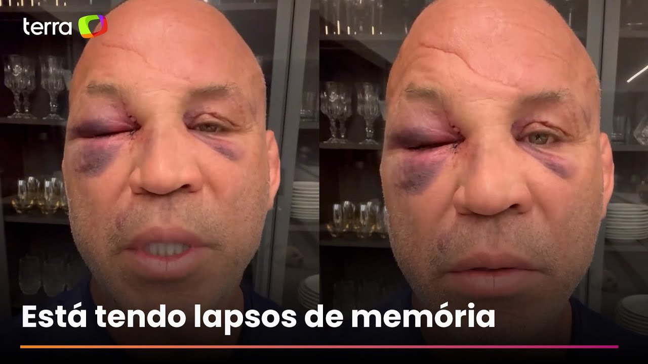 Wanderlei Silva relata dores de cabeça após briga em luta com Popó: 'magoado por dentro e por fora'