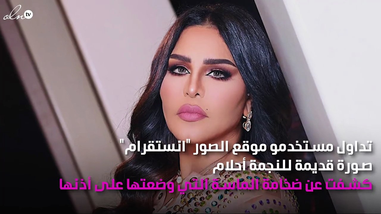 ماسة أحلام الضخمة كادت أن تشطر أذنها.. شاهدي الصورة