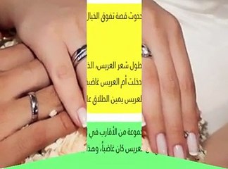 طلاق عروس سعودية أثناء حفل زفافها والسبب شعر العريس! ‏