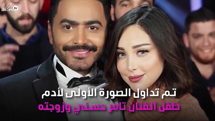 حقيقة الصورة الأولى لطفل لتامر حسني