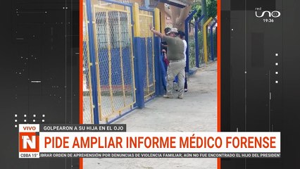 ESTUDIANTE GOLPEADA EN EL OJO PEDIRÁ AYUDA PSICOLÓGICA