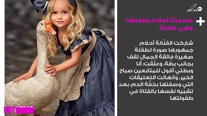 صدمتنا أحلام بصورتها وهي طفلة.. هل تغيّرت كثيراً؟