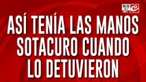Triple crimen narco: sí tenía las manos Socaturo cuando lo detuvieron