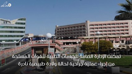 حالة ولادة نادرة لجنين داخل جنين في مستشفى القوات المسلحة بالطائف