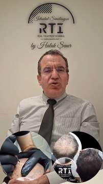 4. SAÇ SİMÜLASYONU NEYE GÖRE PLANLANIR? (SAÇ SİMÜLASYONU AKADEMİSİ)