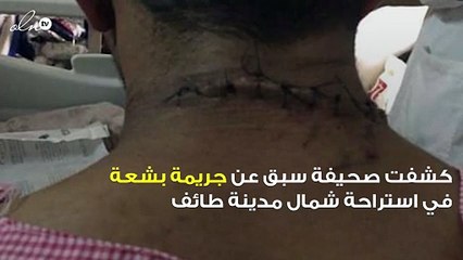 بالصور مضاربة دموية بالطائف بين ثلاثة أصدقاء والسبب غير ملعوم