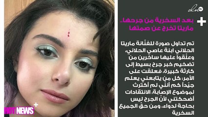 بعد السخرية من جرحها.. ماريتا الحلّاني تخرج عن صمتها