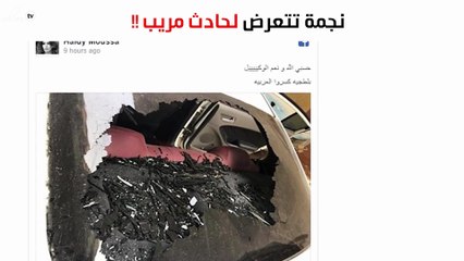 نجمة ستار أكاديمي تتعرّض لحادث!